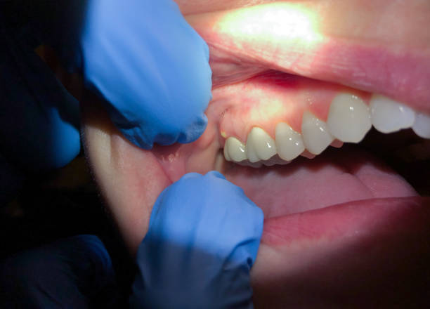 Best Pediatric Emergency Dentist in Rossville, MD