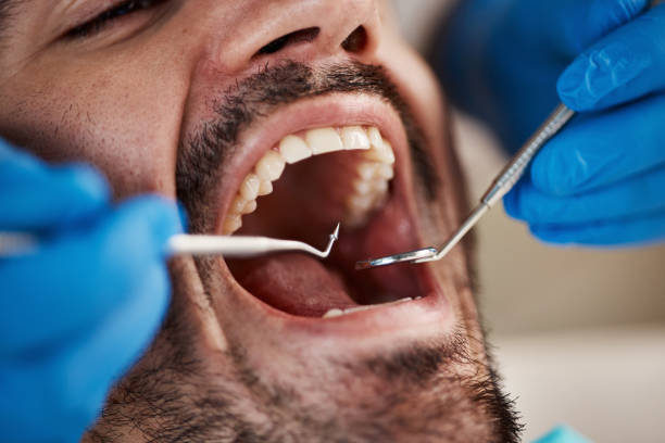 Best Emergency Denture Repair in Rossville, MD